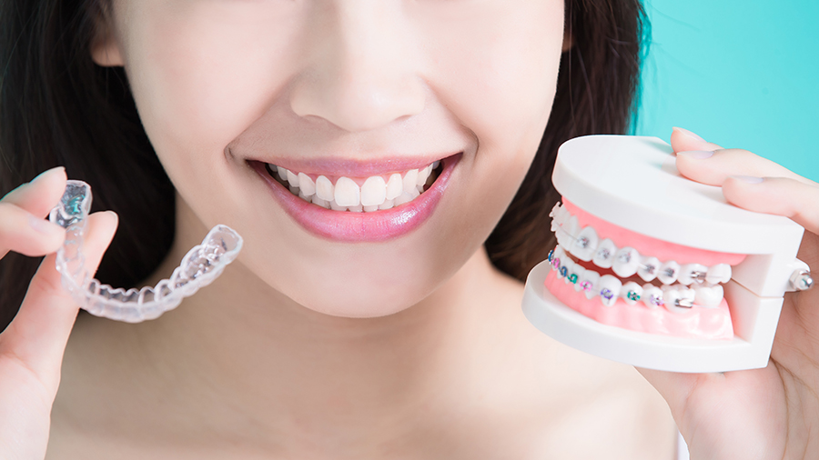 Invisalign clear aligners dentist in Columbus OH