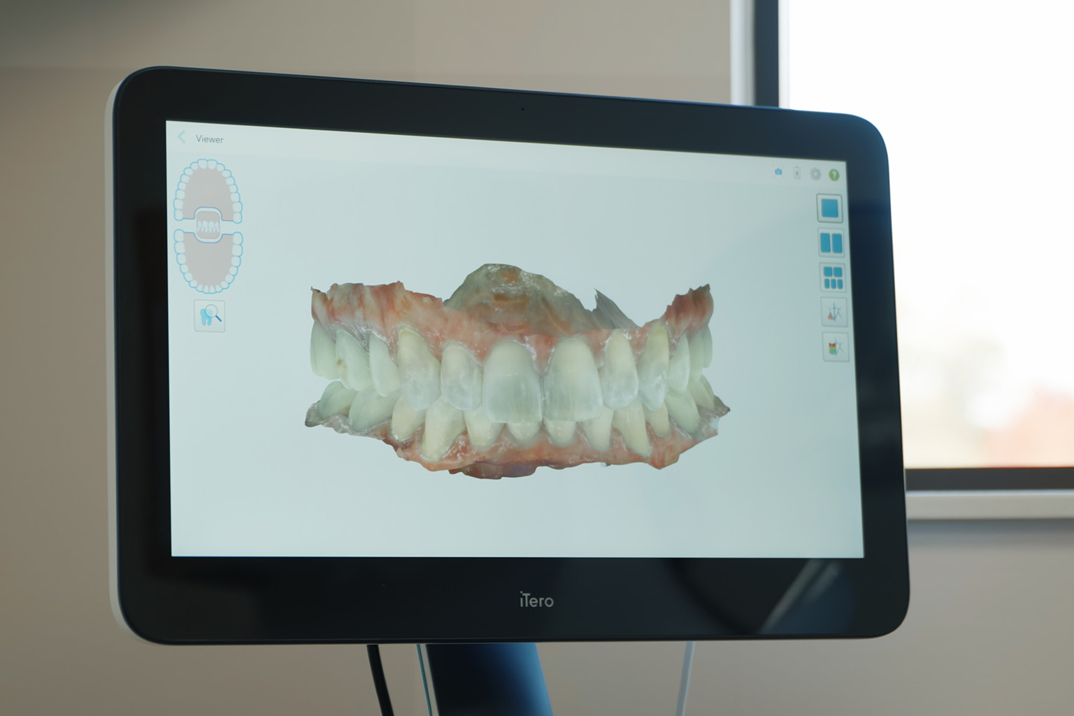 Hilliard Oh Invisalign Dentist